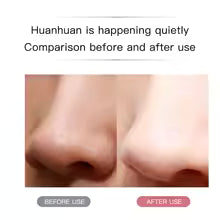 Ultrasonic Skin Scrubber